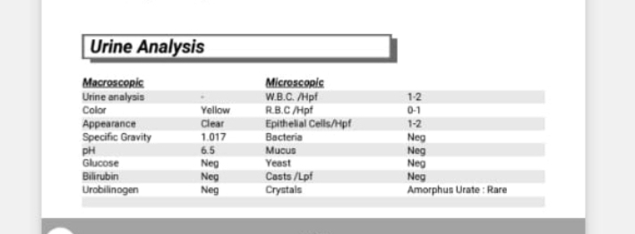 عفونت ادراریم ندارم عفونت ادراریم ندارم