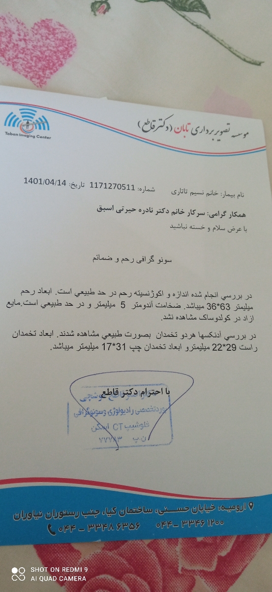 لکه قهویی چن روز بعد پریوپ لکه قهویی چن روز بعد پریوپ