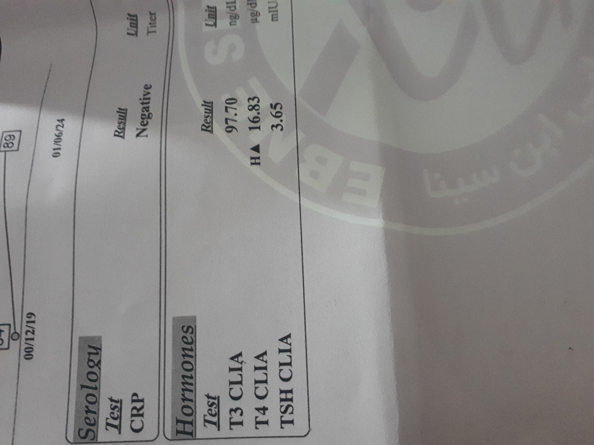 تفسیر آزمایش تیروئید من