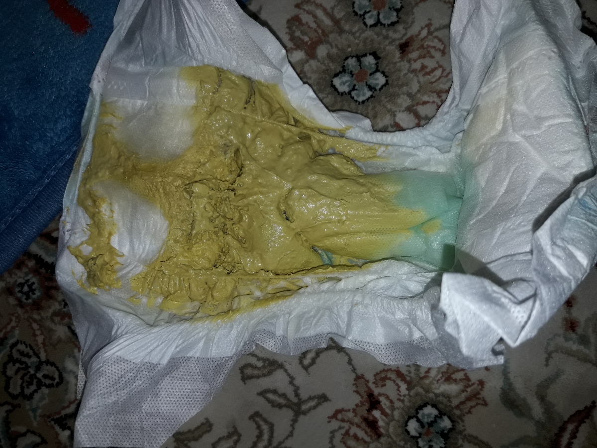 اورژانسی اسهال بسیار شدید کودک اورژانسی اسهال بسیار شدید کودک