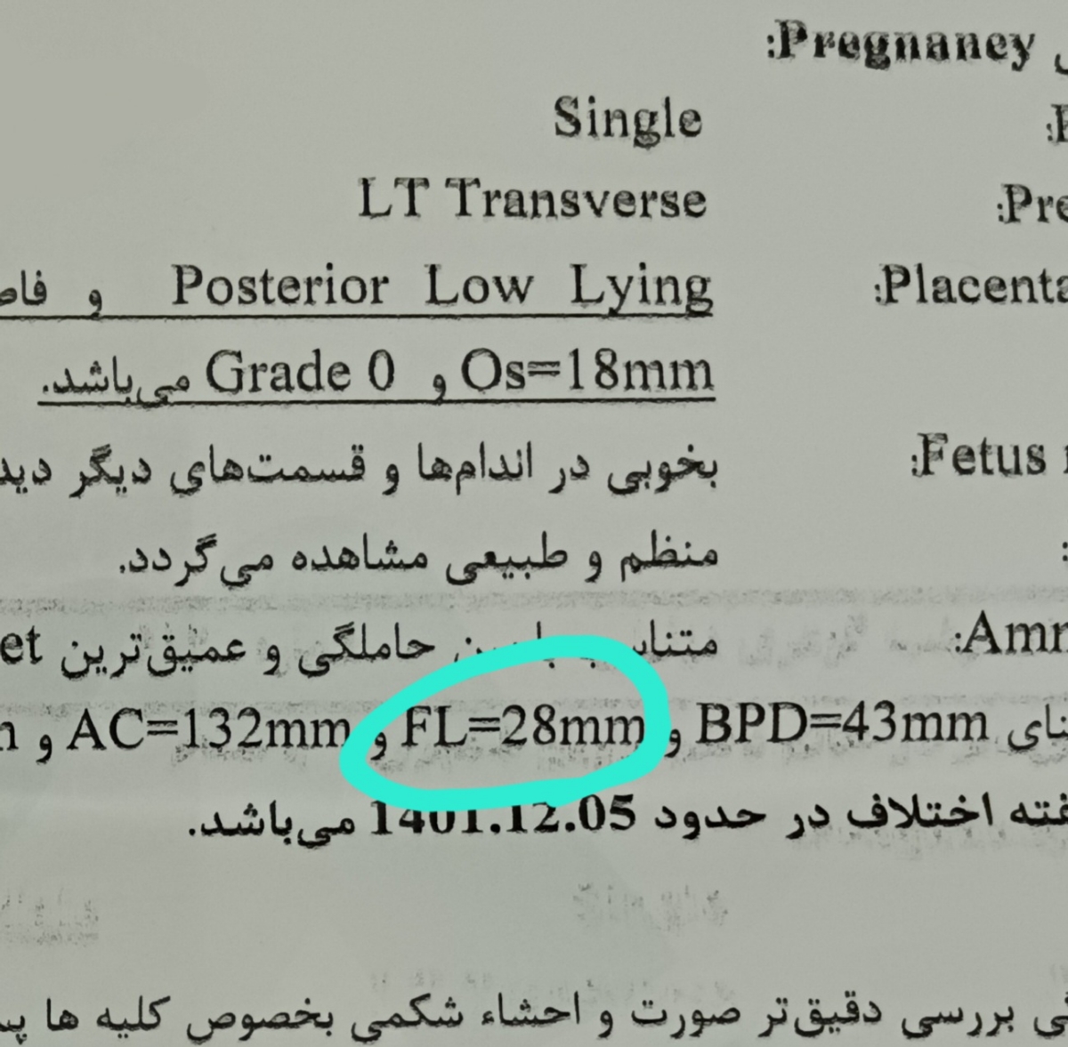 البته اینجا FL رو زده ۲۸mm البته اینجا FL رو زده ۲۸mm