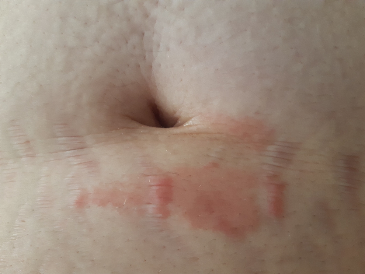 اینم عکسش هستش اینم عکسش هستش