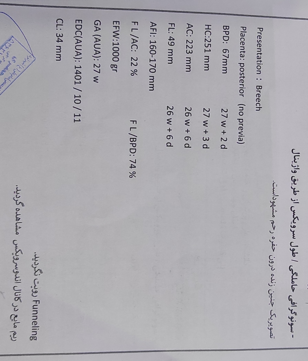 لکه بینی در هفته 27 بارداری لکه بینی در هفته 27 بارداری