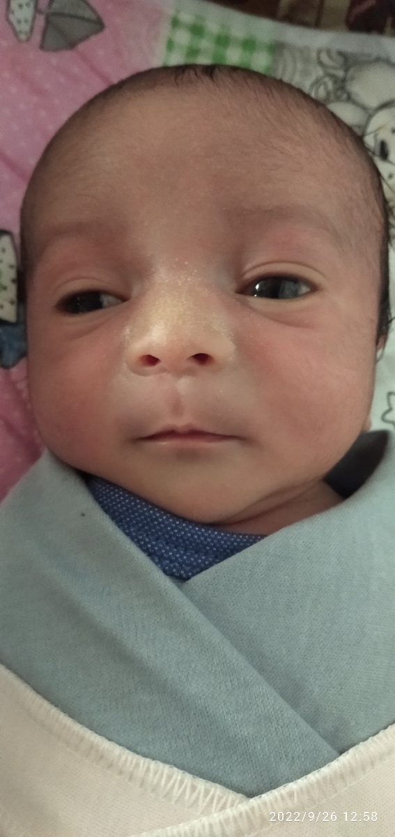 کوچک بودن چشم دوقلوهام کوچک بودن چشم دوقلوهام