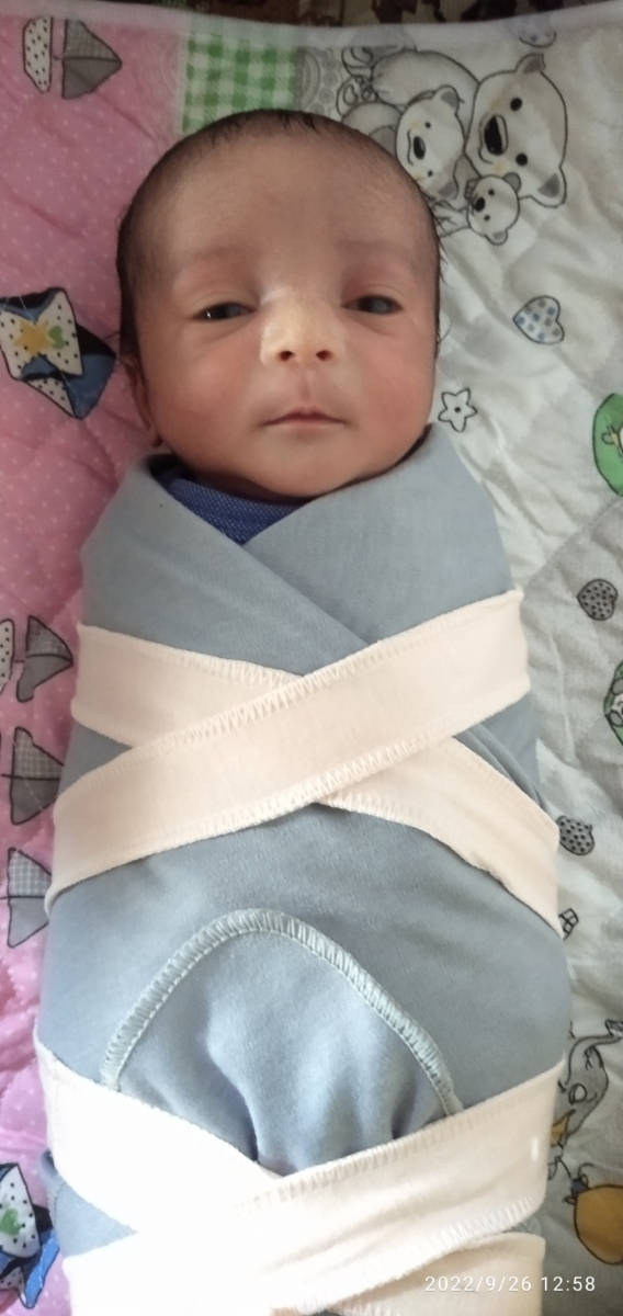 کوچک بودن چشم دوقلوهام کوچک بودن چشم دوقلوهام