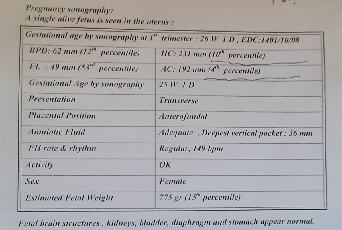 سونو رشد جنین سونو رشد جنین