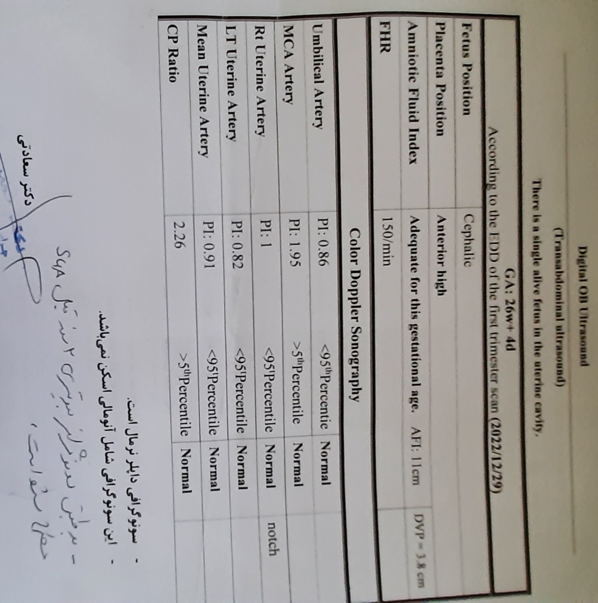 سونو داپلر سونو داپلر