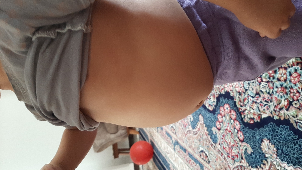 شکم دخترم انگار خیلی باد داره + عکس