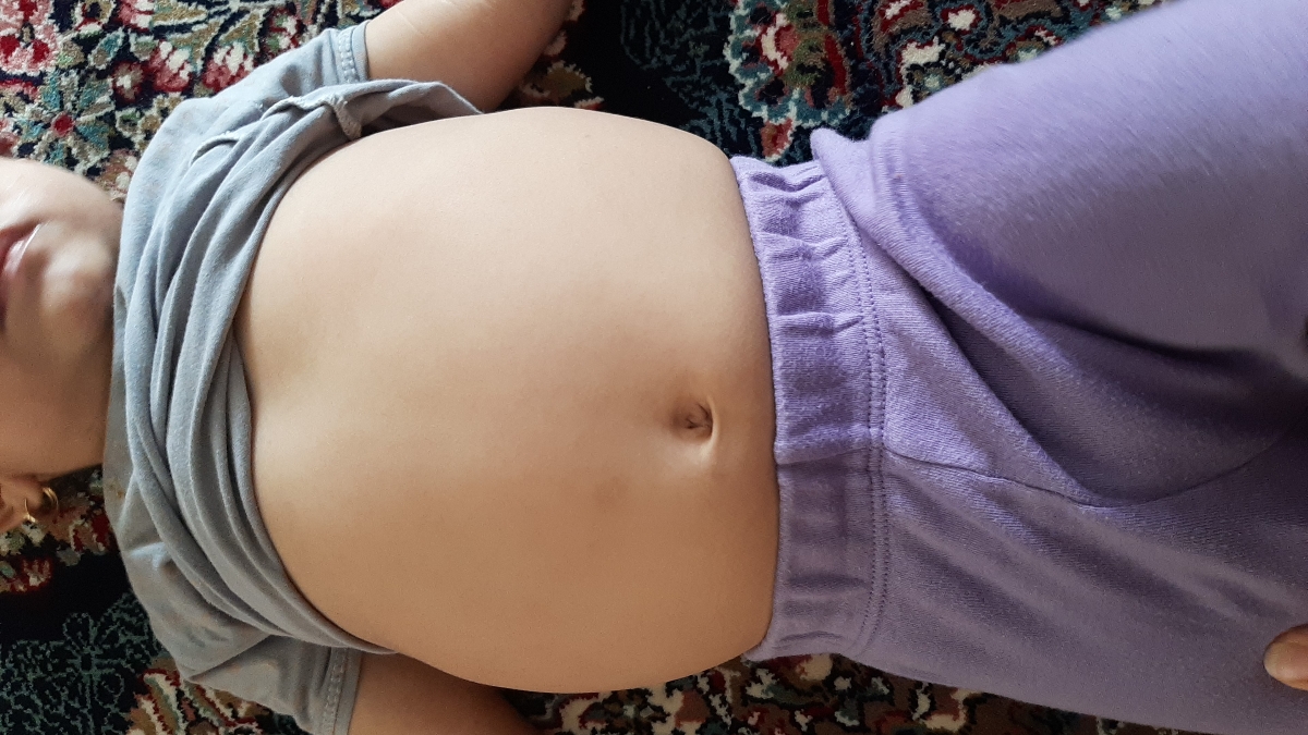 شکم دخترم انگار خیلی باد داره + عکس