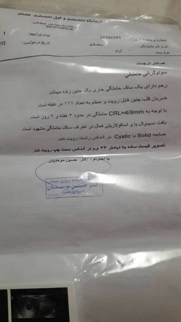 اینه سونو ایی ک۱۳ ماه شهریور دادم اینه سونو ایی ک۱۳ ماه شهریور دادم