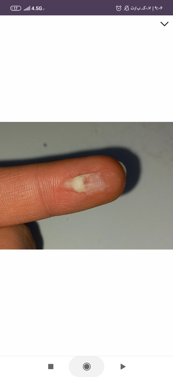 این ترشحات من نیست فقط مال من شبیه این و زیاد است این ترشحات من نیست فقط مال من شبیه این و زیاد است