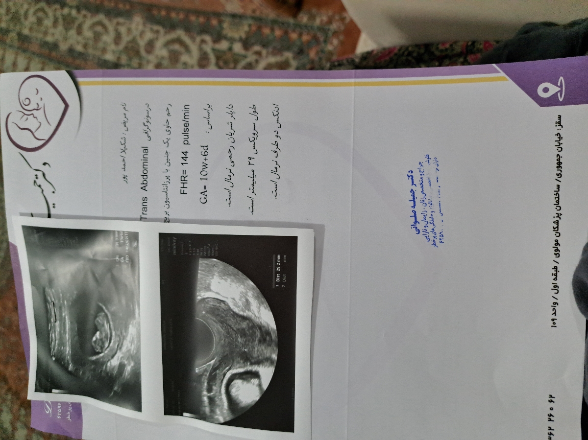 ایا طول سرویکسم کم نیست ایا طول سرویکسم کم نیست