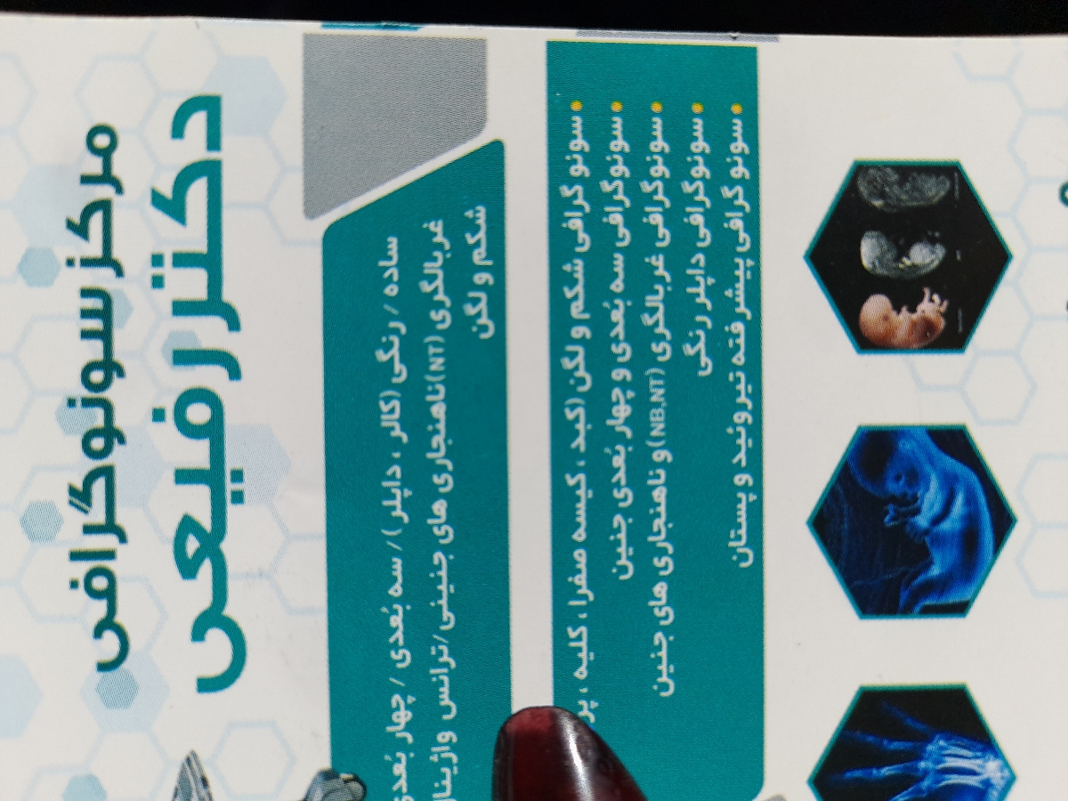 بارداری با تخم دان کوچک بارداری با تخم دان کوچک