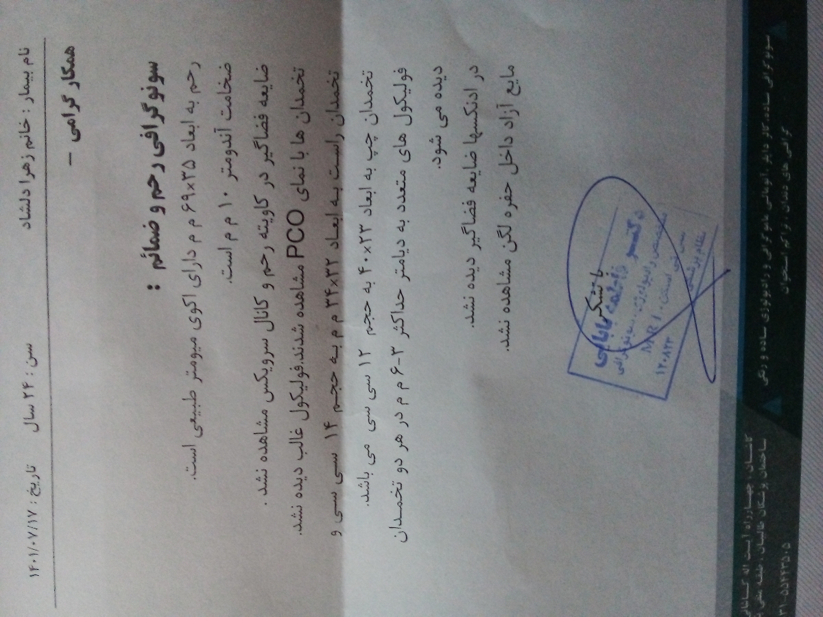 درد و ورم سینه روز ۱۴ و ۱۵ سیکل درد و ورم سینه روز ۱۴ و ۱۵ سیکل