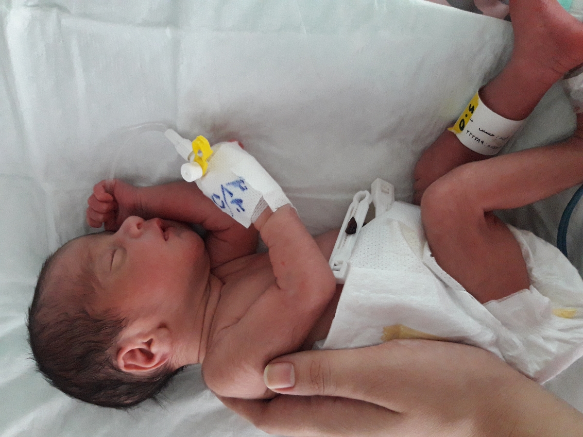 نوزاد نارس بیست و شش هفته نوزاد نارس بیست و شش هفته