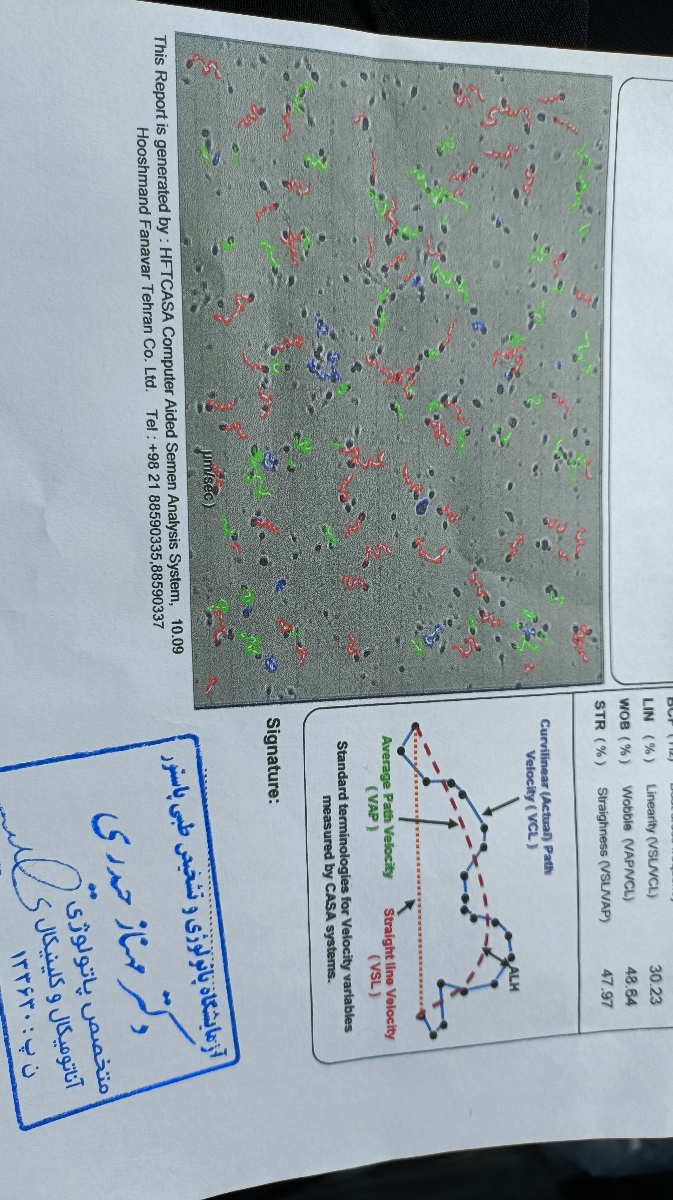 تفسیر آزمایش آنالیز اسپرم