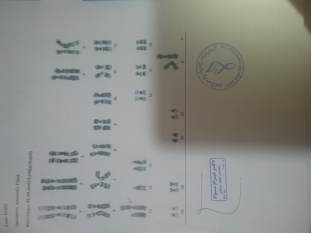 تست اپینوسنتز و کاریو تایپ