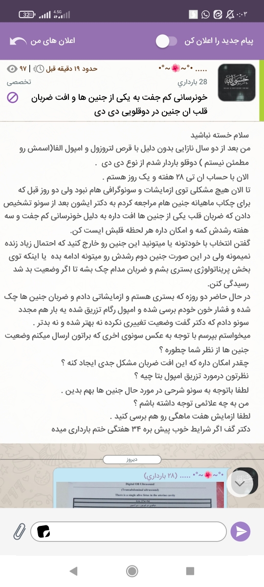 نارسایی جفت و افت ضربان جنین در بارداری دو قلویی از نوع دی دی نارسایی جفت و افت ضربان جنین در بارداری دو قلویی از نوع دی دی