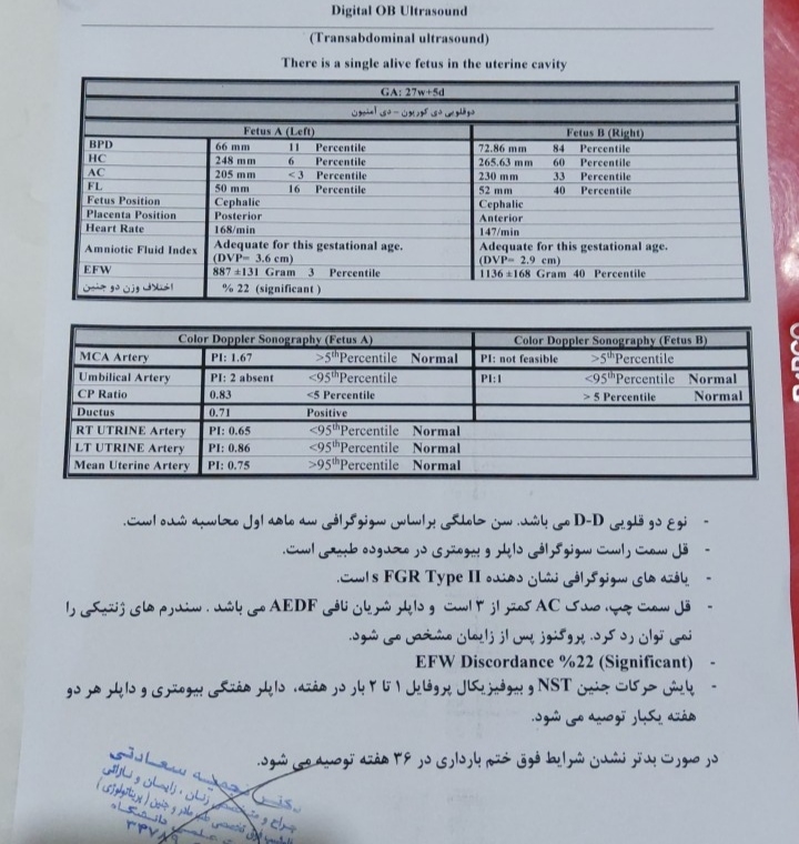 نارسایی جفت و افت ضربان جنین در بارداری دو قلویی از نوع دی دی نارسایی جفت و افت ضربان جنین در بارداری دو قلویی از نوع دی دی