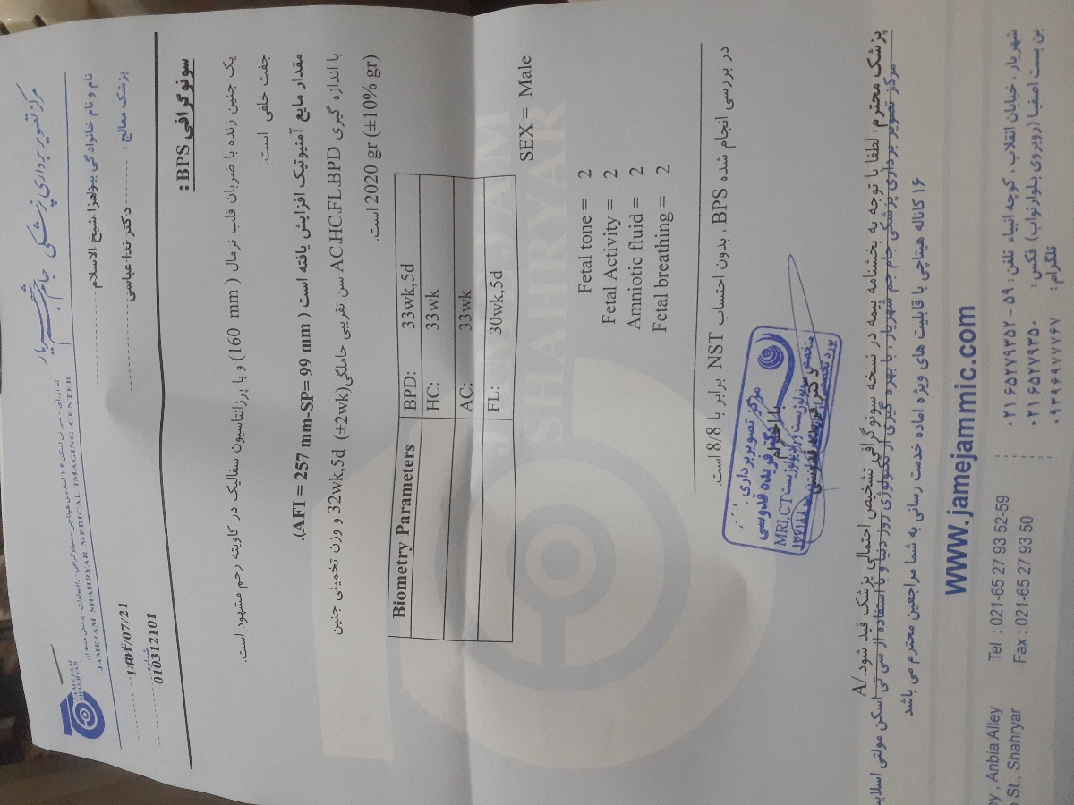 اینم واسه امروزه که ۳۱ هفته وسه روزمه
