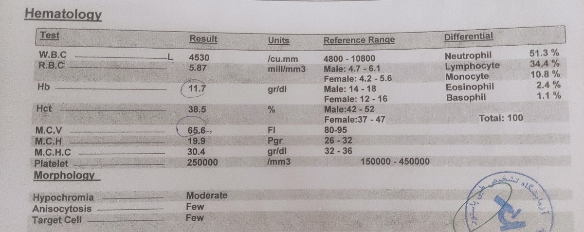 خانم دکتر عزیزم آزمایش هورمونی رو تفسیر میکنید؟