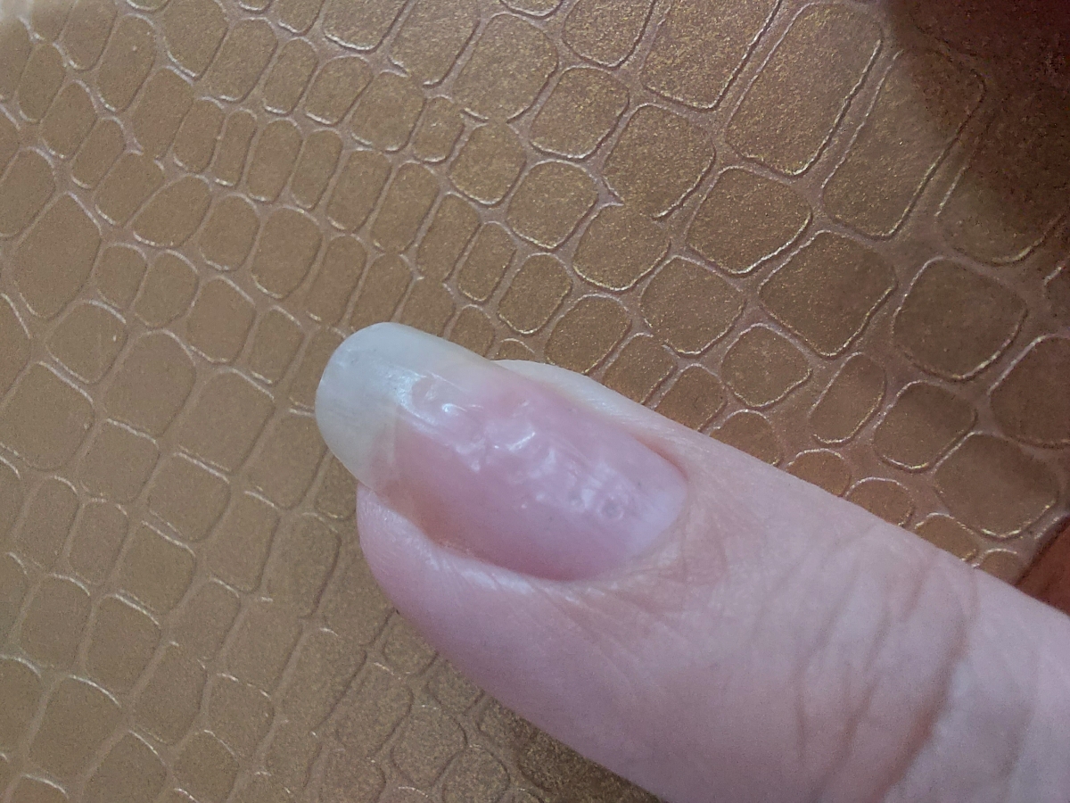 خانوم دکتر اگه ممکنه آزمایش منو تفسیر کنید تشکر