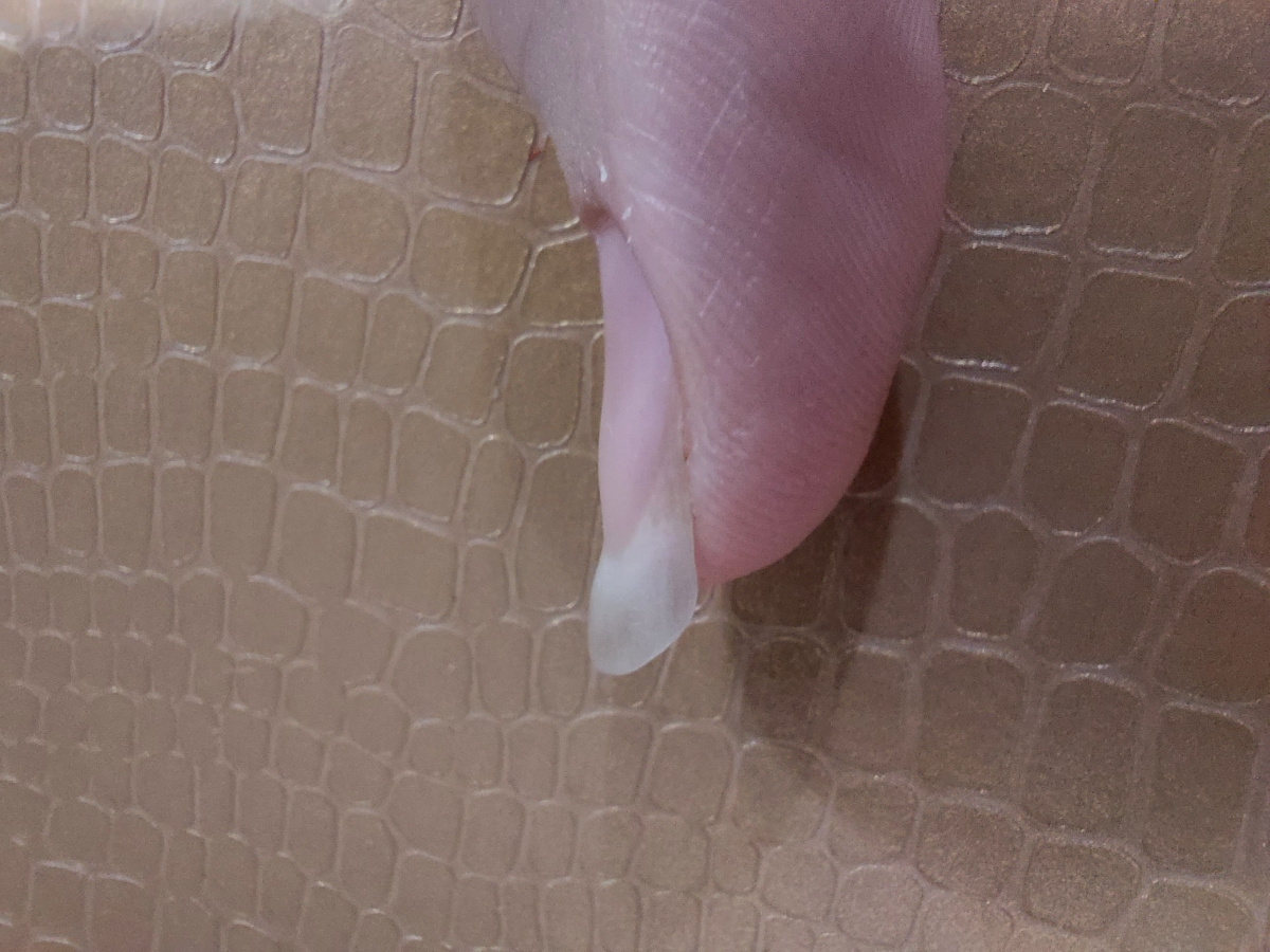 خانوم دکتر اگه ممکنه آزمایش منو تفسیر کنید تشکر