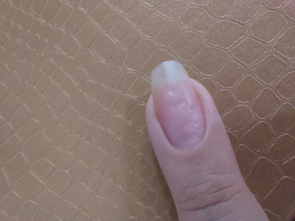 خانوم دکتر اگه ممکنه آزمایش منو تفسیر کنید تشکر