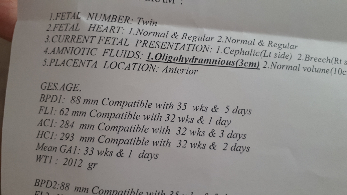 لطفا بیایید دقیق بگید سونو چطوری لطفا بیایید دقیق بگید سونو چطوری