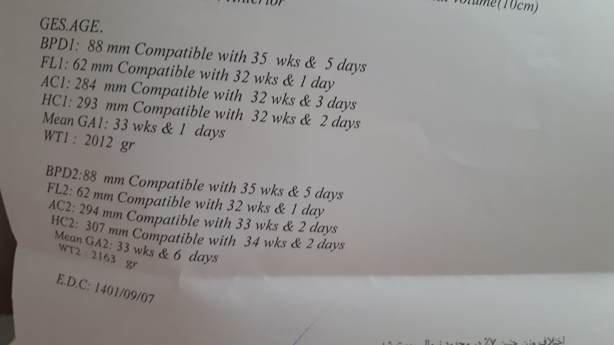 لطفا بیایید دقیق بگید سونو چطوری لطفا بیایید دقیق بگید سونو چطوری