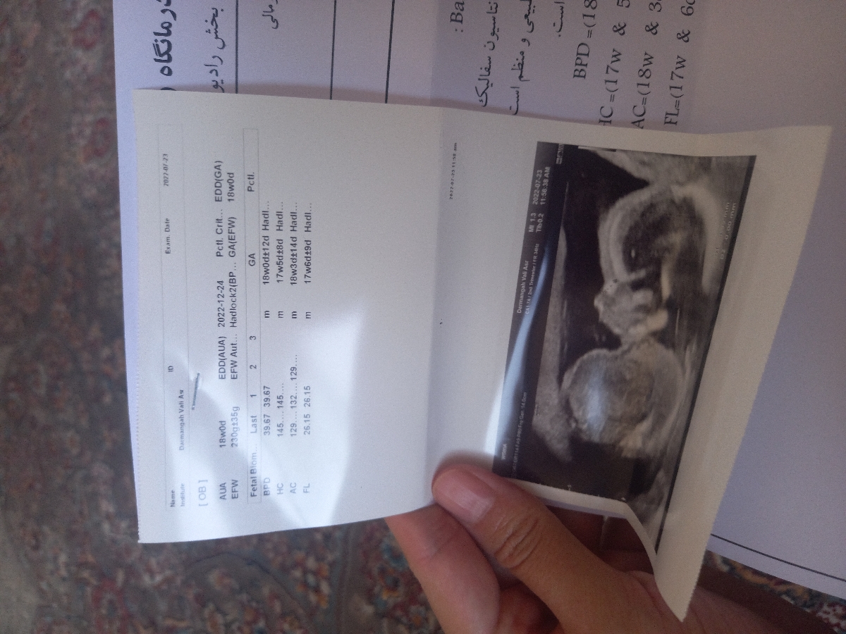 تفسیر سونوی آنومالی هفته۱۸ تفسیر سونوی آنومالی هفته۱۸