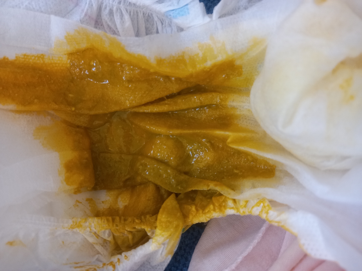 آیا این عکس مدفوع نوزادم اسهال است