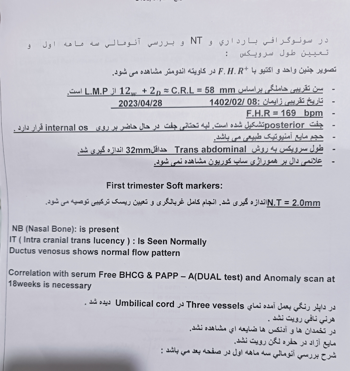 عدد ان تی چطوره ؟