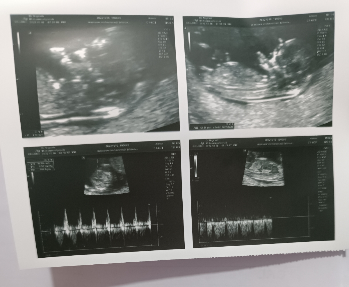 عدد ان تی چطوره ؟