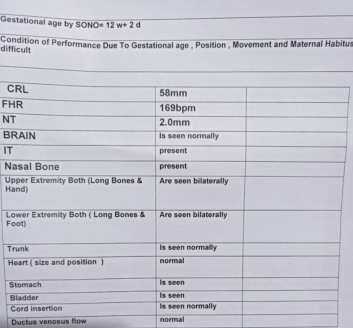 عدد ان تی چطوره ؟