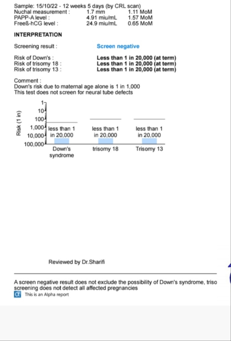 این ازمایشمه 