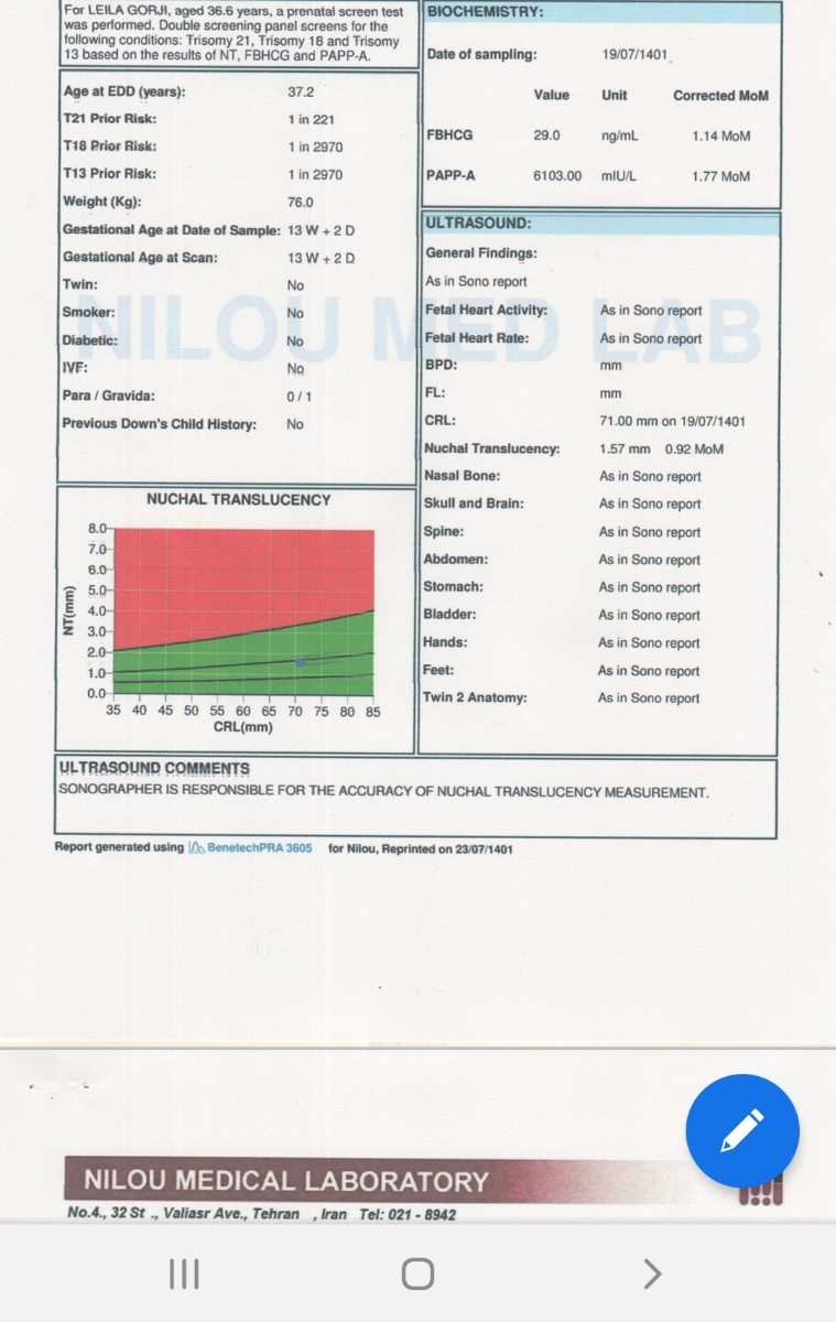 بررسی سونو و آزمایش غربالگری (Nt)