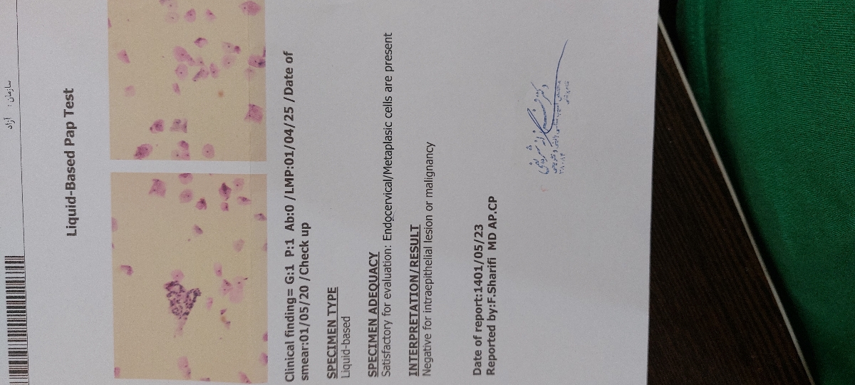 خونریزی روز ۱۰ پریودی