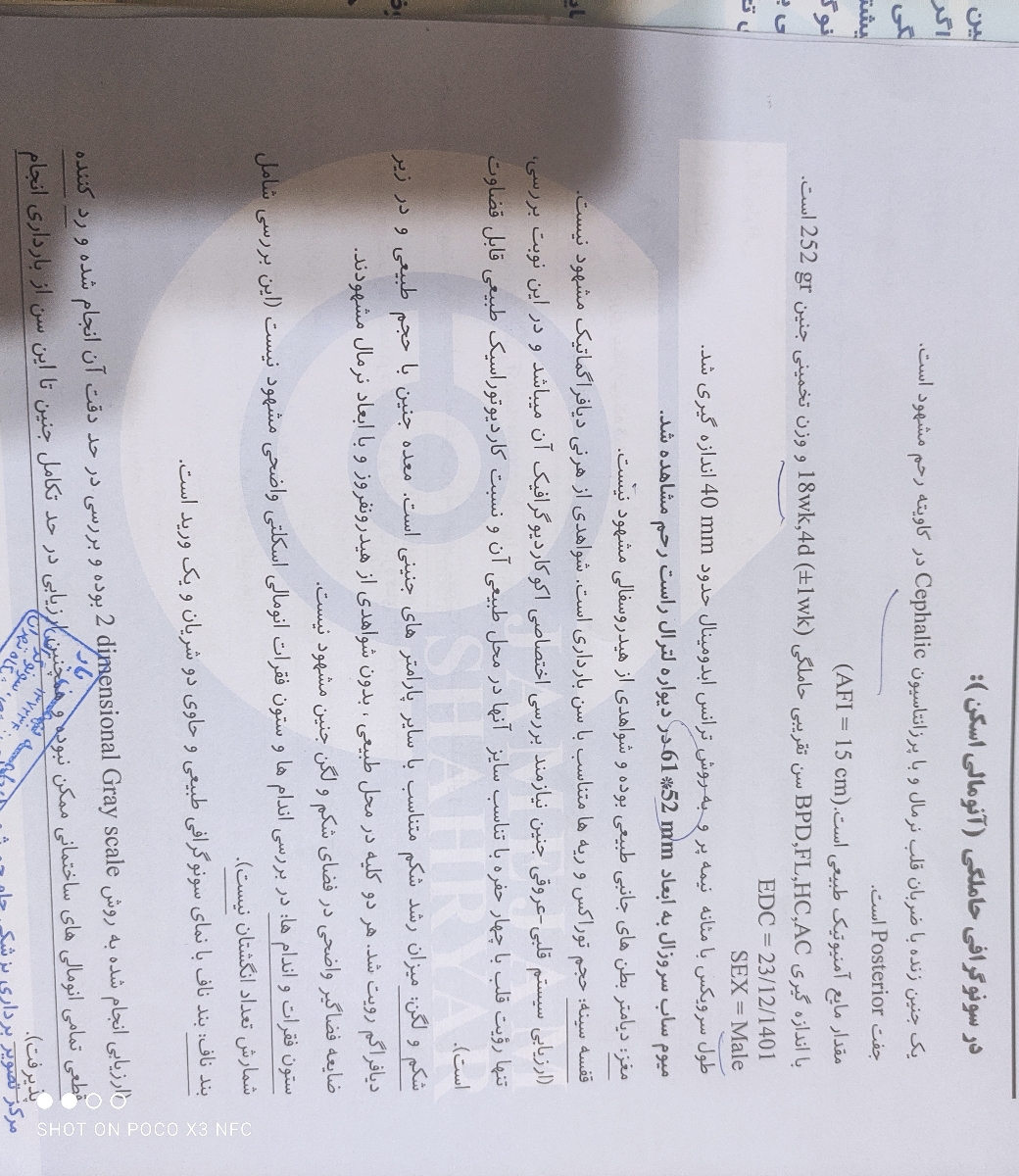 سونوگرافی انومالی همراه با یه سوال ریز😁😥