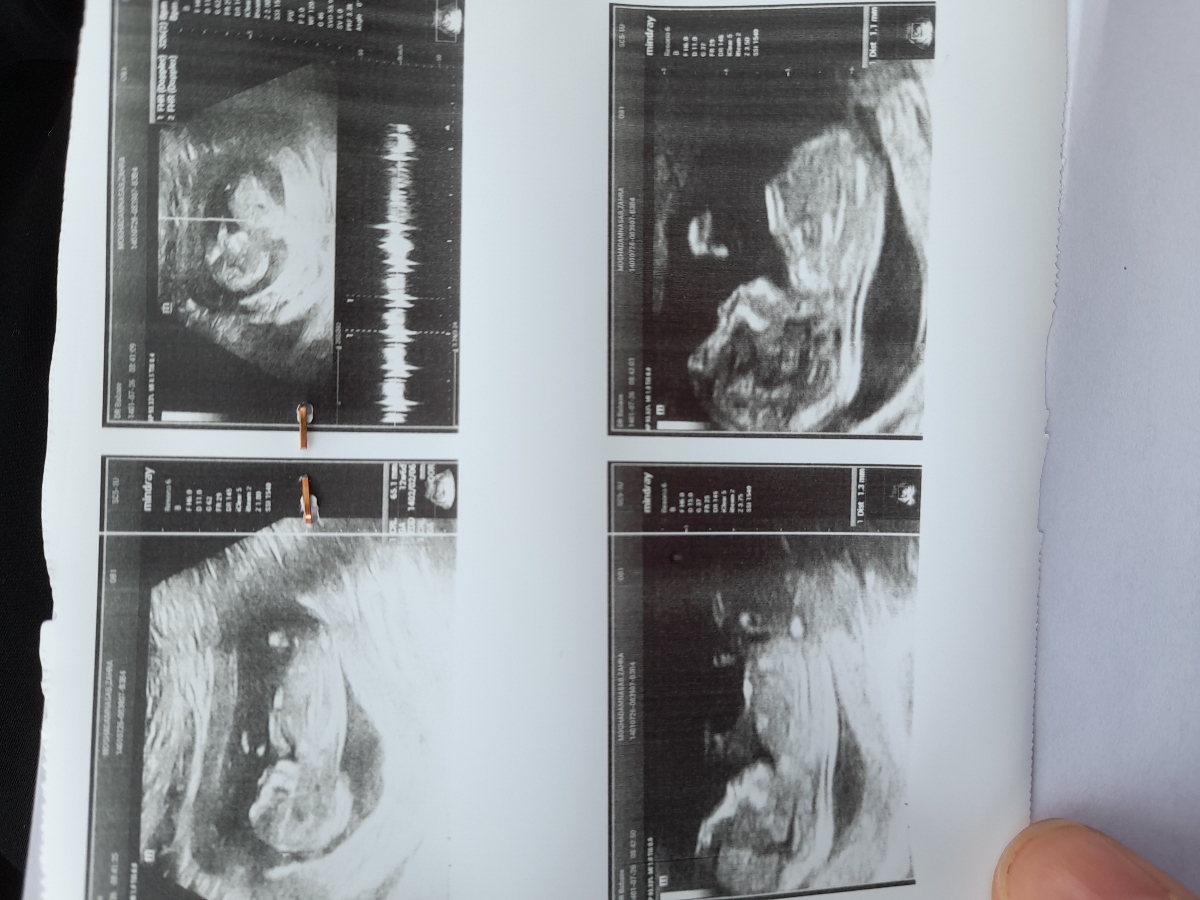 سلام عشقا منم رفتم NT سلام عشقا منم رفتم NT