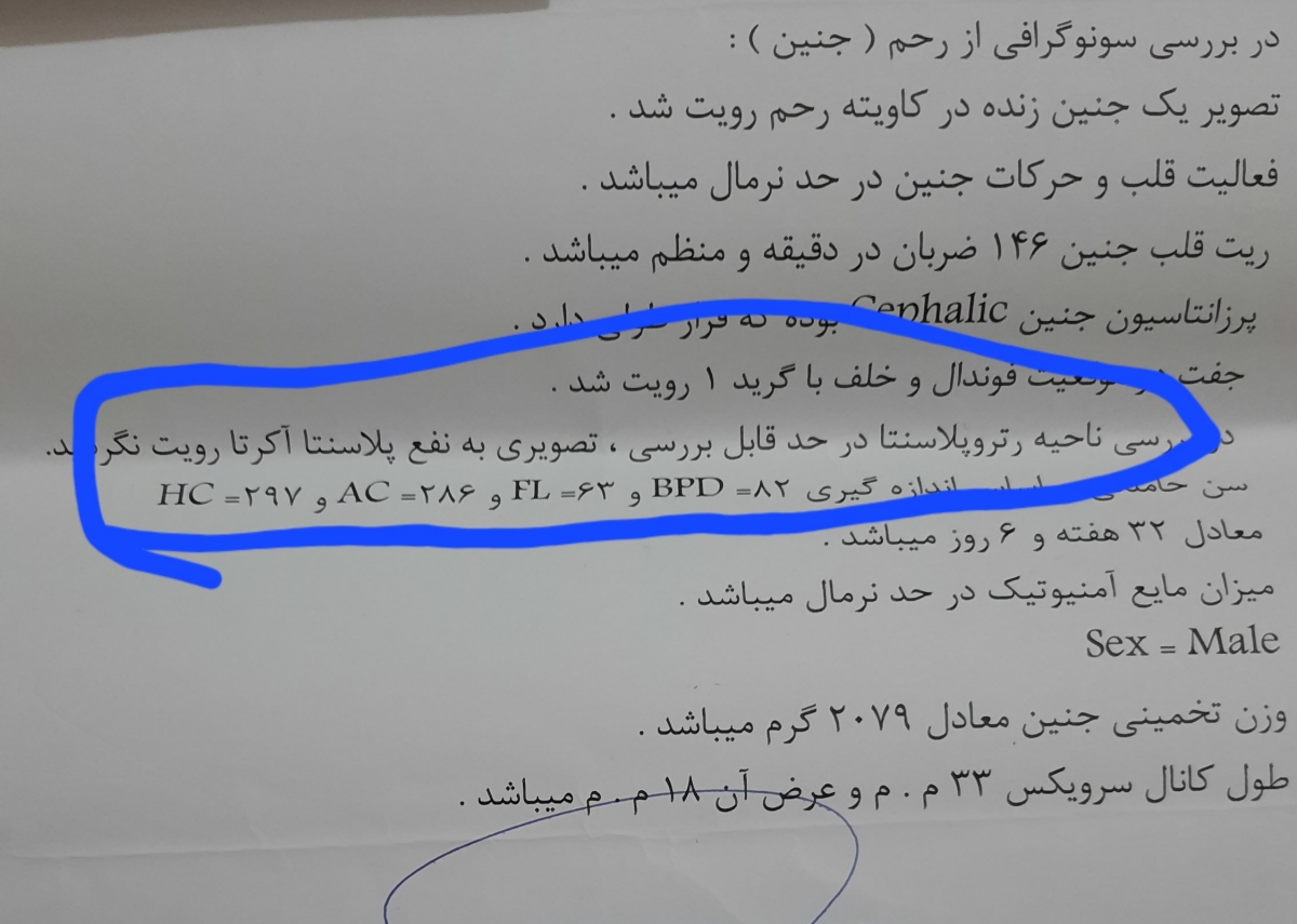بارداری سوم و چسبندگی مثانه