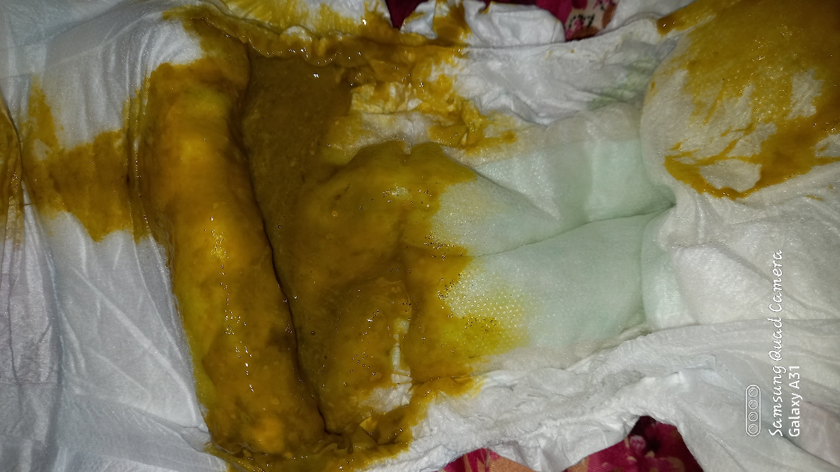 اسهالم هست انگار