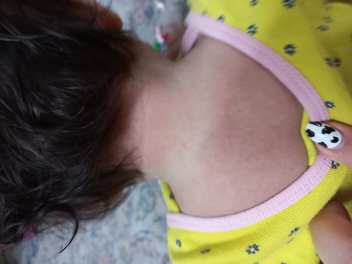 این پشت سرش کلا قرمزه حتی داخل موهاش این پشت سرش کلا قرمزه حتی داخل موهاش