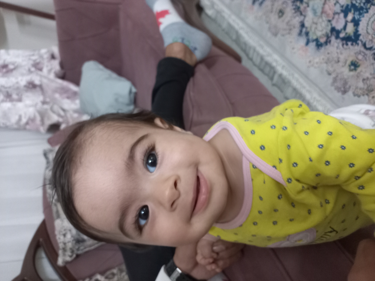 دونه های قرمز رو کل بدن بچه ۹ ماهه دونه های قرمز رو کل بدن بچه ۹ ماهه