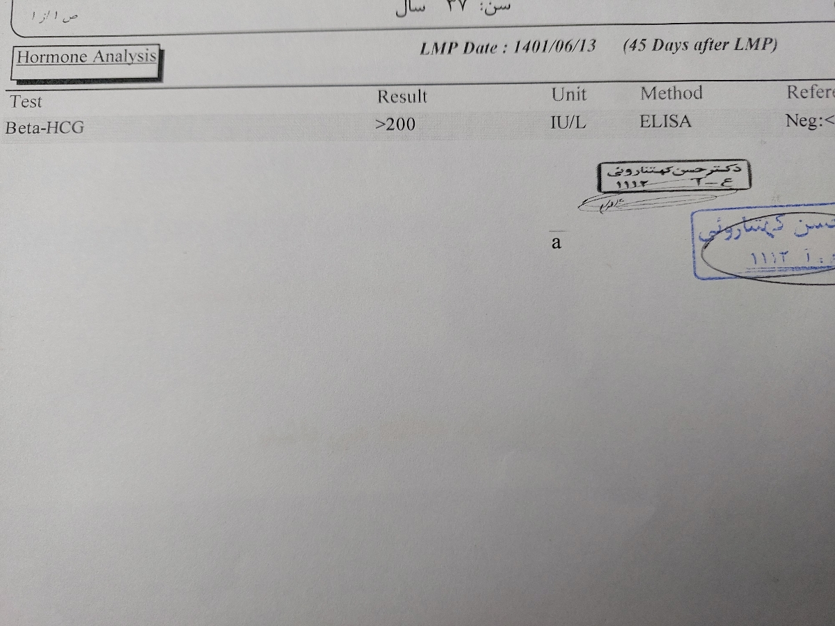 پریود نشدن بعد شانزده روز پریود نشدن بعد شانزده روز