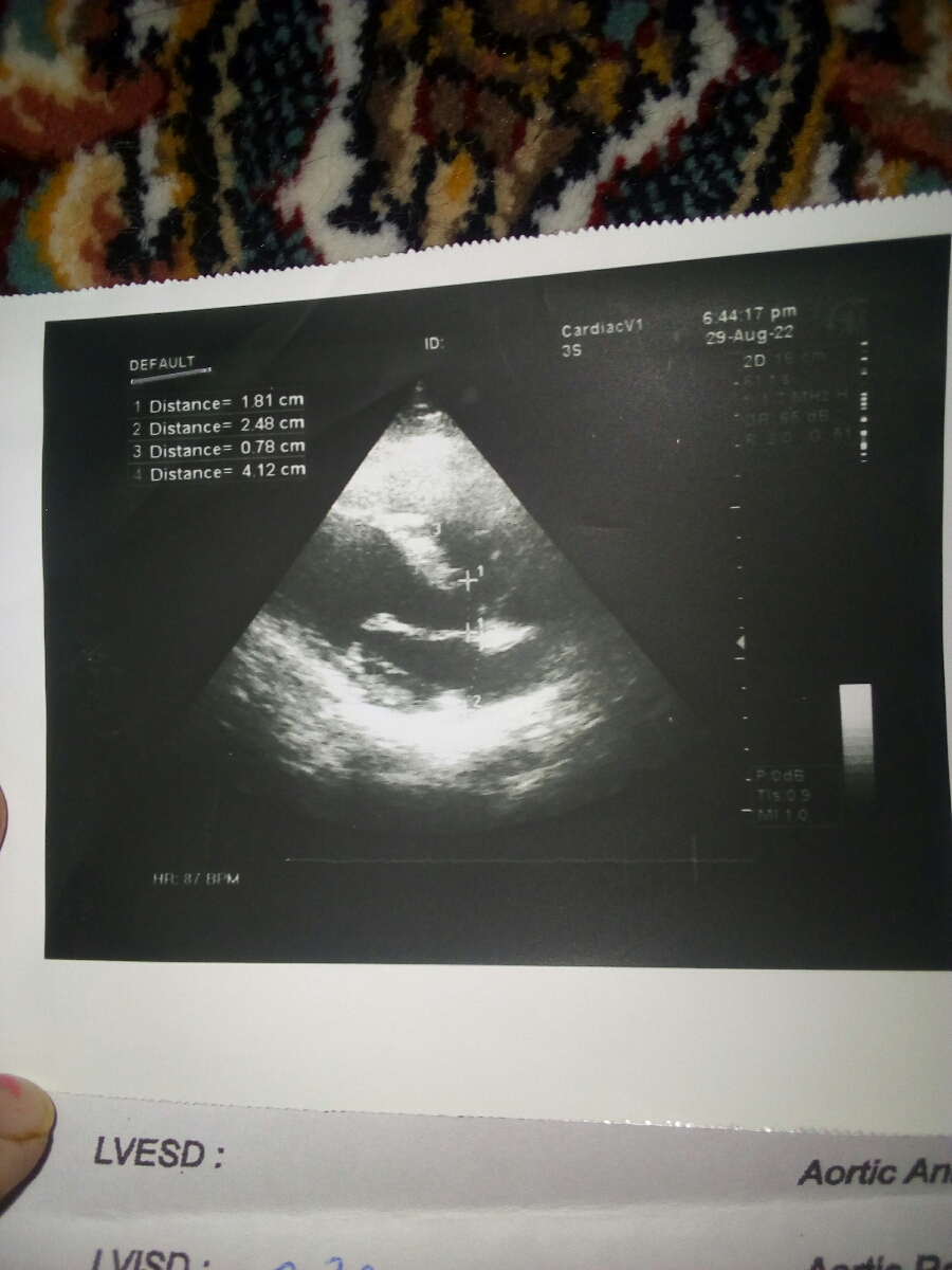 سلام پزشک عزیز و دوستان گل در مورد درد قفسه سینه سلام پزشک عزیز و دوستان گل در مورد درد قفسه سینه