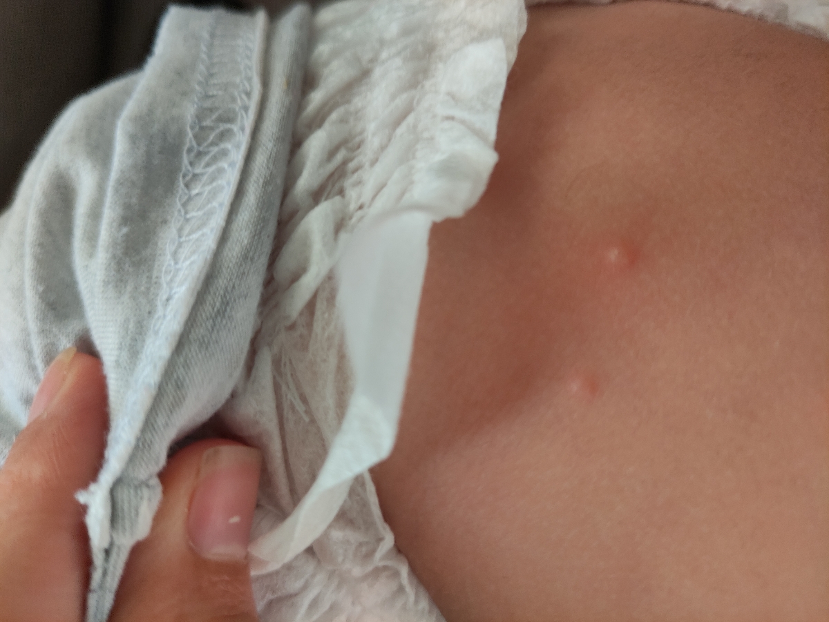 دونهای روی پای پسرم چیه دکتر جان دونهای روی پای پسرم چیه دکتر جان