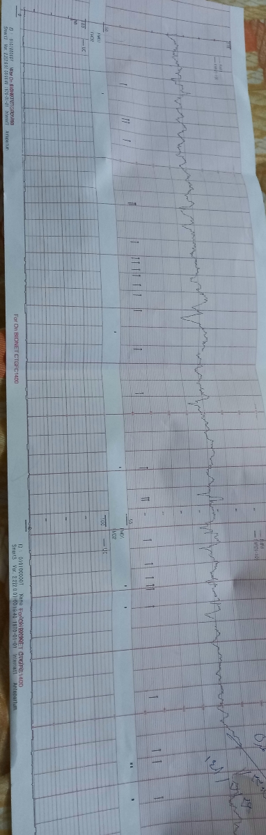 سلام پزشک اوما لطفا داپلرروبرا تفسیرکنید