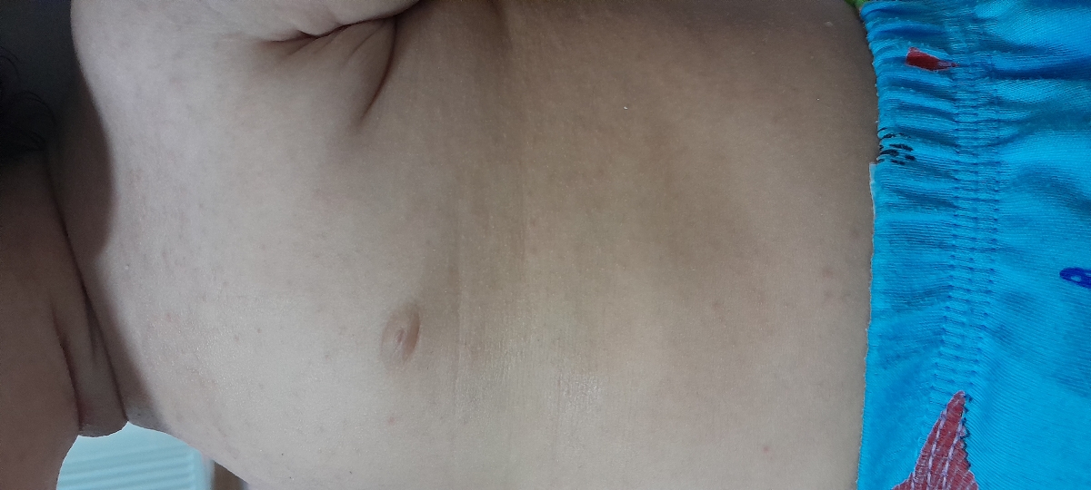 خروپف و کیپ بودن بینی خروپف و کیپ بودن بینی