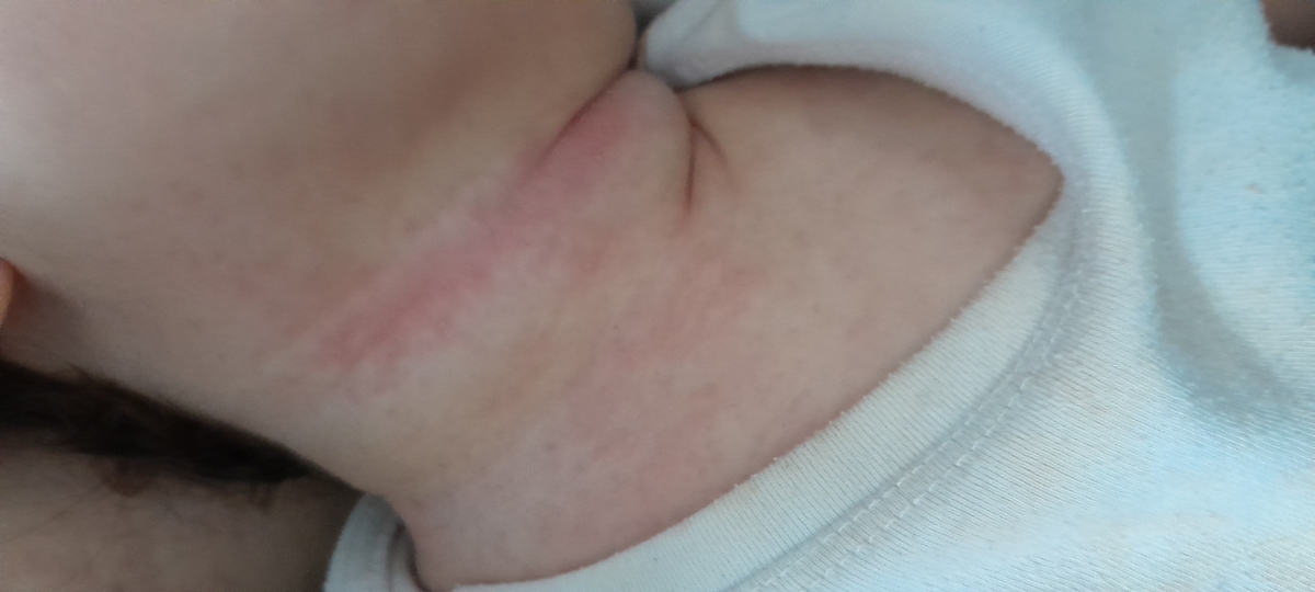 خروپف و کیپ بودن بینی خروپف و کیپ بودن بینی